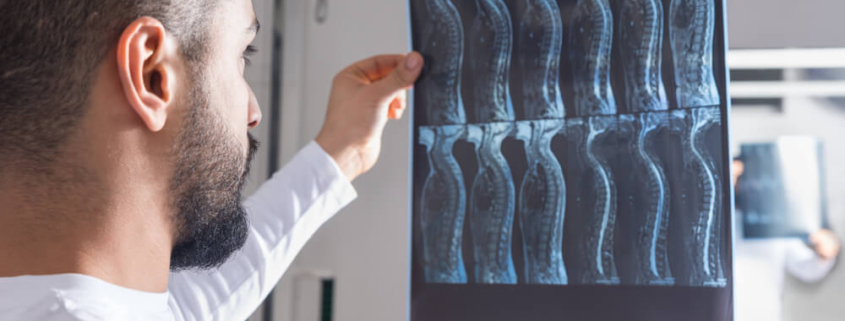 Spinal Injuries - What You Need to Know